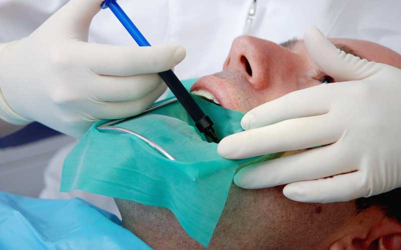 Root Canal Treatment